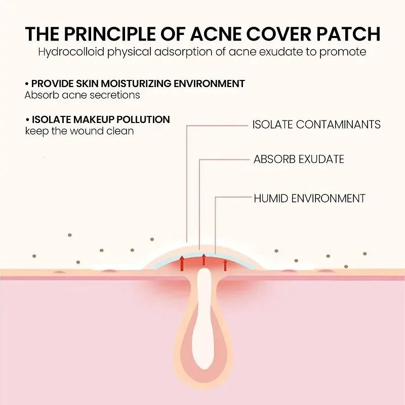 200pcs Repair Acne Patch Facial Skin Care Fade Blemishes Pimple Marks